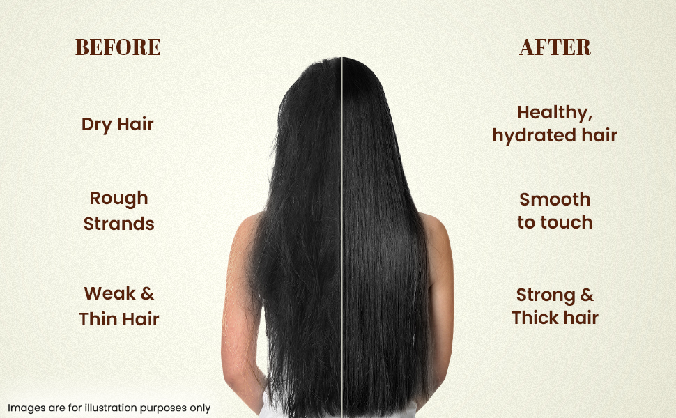 Zandu Hair Growth Mask (200g)|Scientifically Proven to Promote Hair Growth & Reduces Hair Fall|Strengthens Roots|Conditioning & Smoothening|Rosemary Oil, Amla & Bhringraj |100% Ayurvedic, No Chemicals