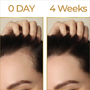 Streax Hair Growth Serum for Scalp, 30 ml with 3% Redensyl, 3% Anagain, 3% Baicapil, Biotin & Caffeine, Hair Serum for Hair Fall Control, For Women & Men