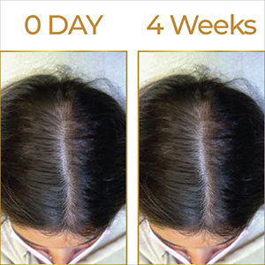 Streax Hair Growth Serum for Scalp, 30 ml with 3% Redensyl, 3% Anagain, 3% Baicapil, Biotin & Caffeine, Hair Serum for Hair Fall Control, For Women & Men