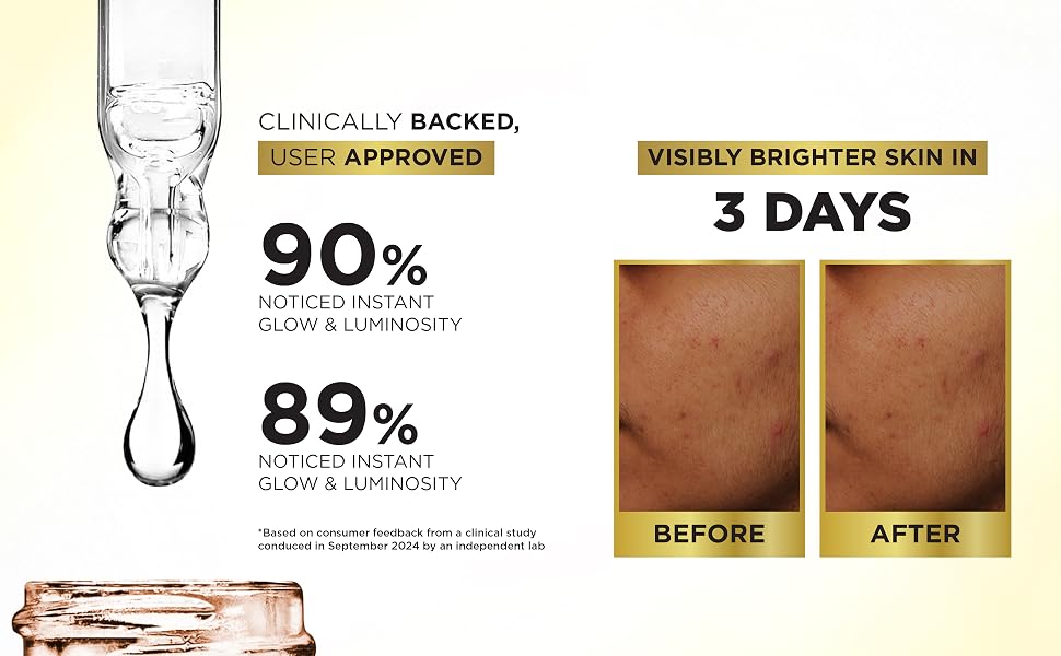 Streax Vitamin C Face Serum, 30 ml | 18% Vitamin C | Dark Spots Reduction | Brighter Skin in 3 Days | Serum for Glowing Skin | Brightening serum | Bright & Shine Face Serum