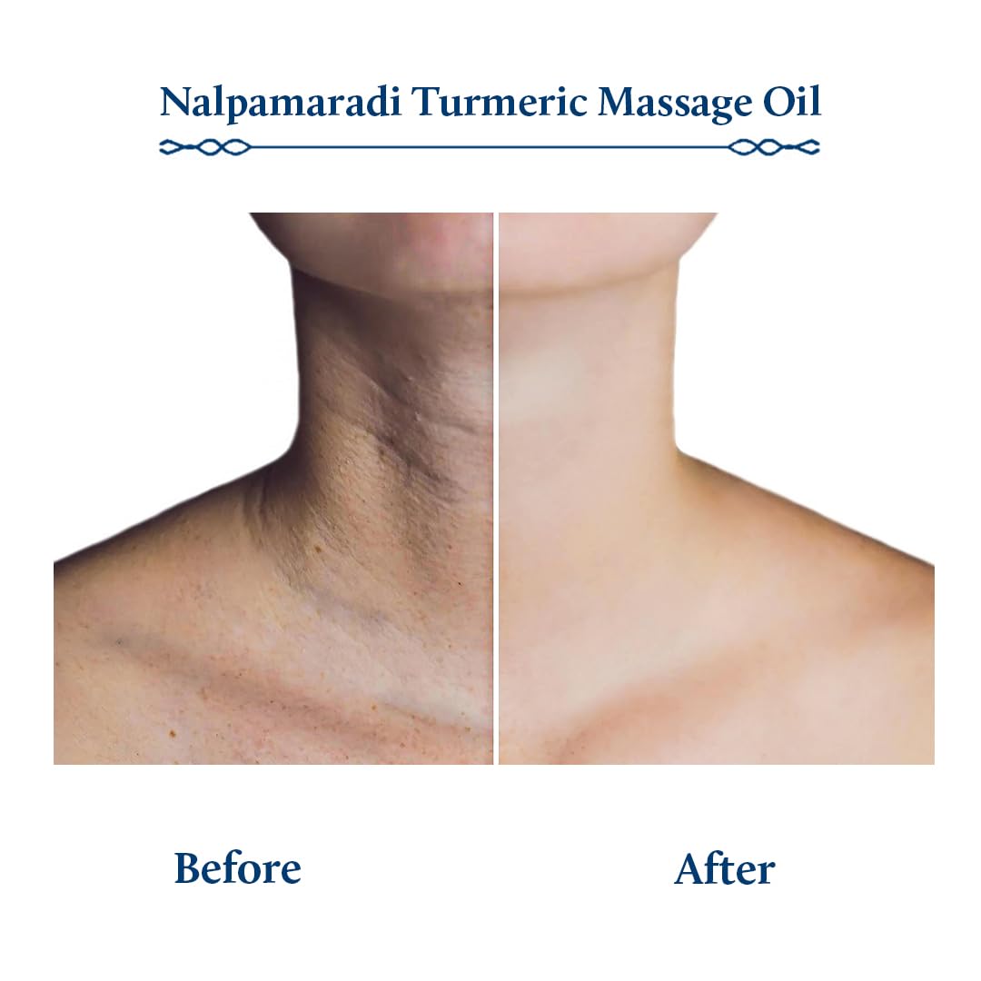 Blue Nectar Nalpamaradi Thailam Skin Brightening Treatment Oil – view 5