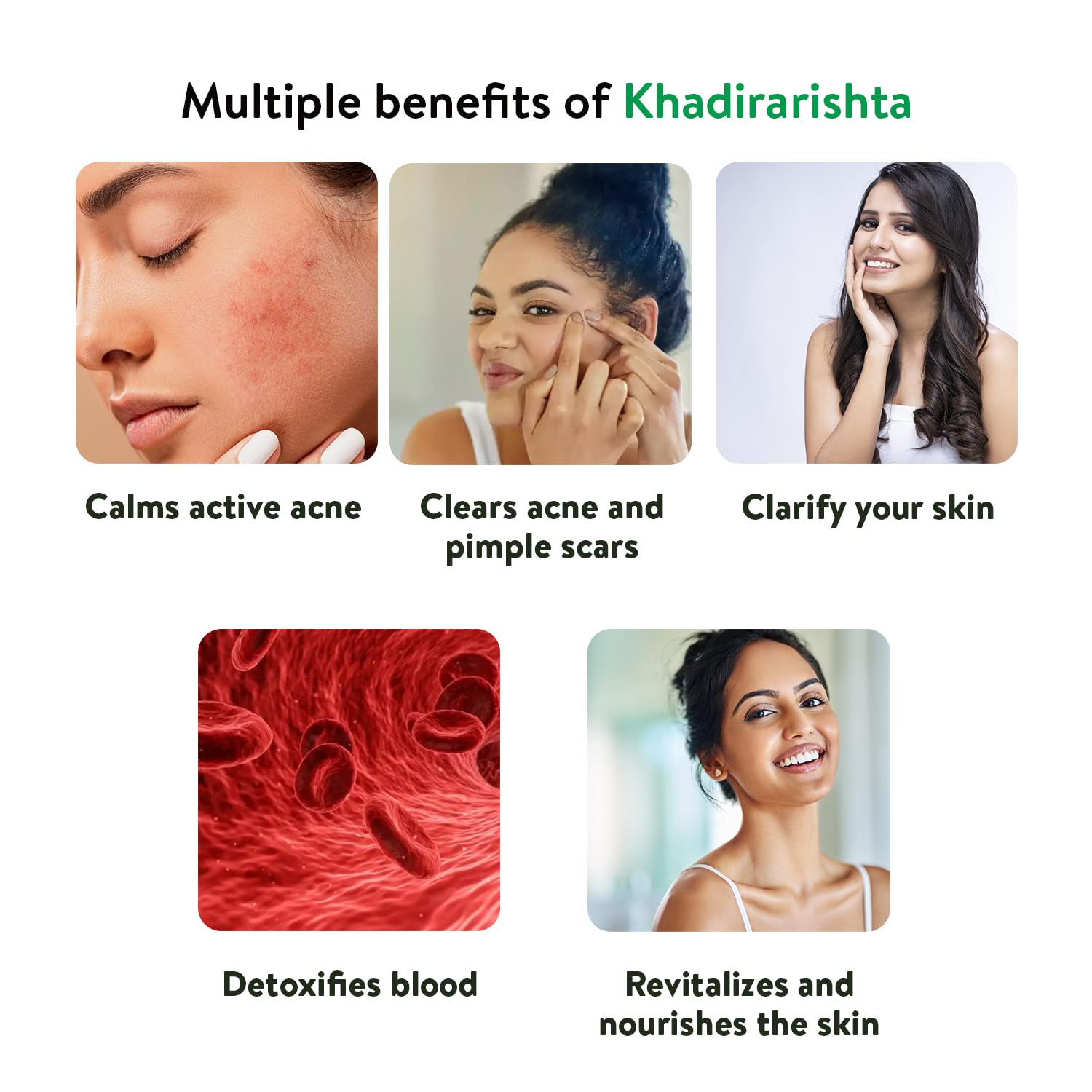Kerala Ayurveda Khadirarishta 450ml – view 2