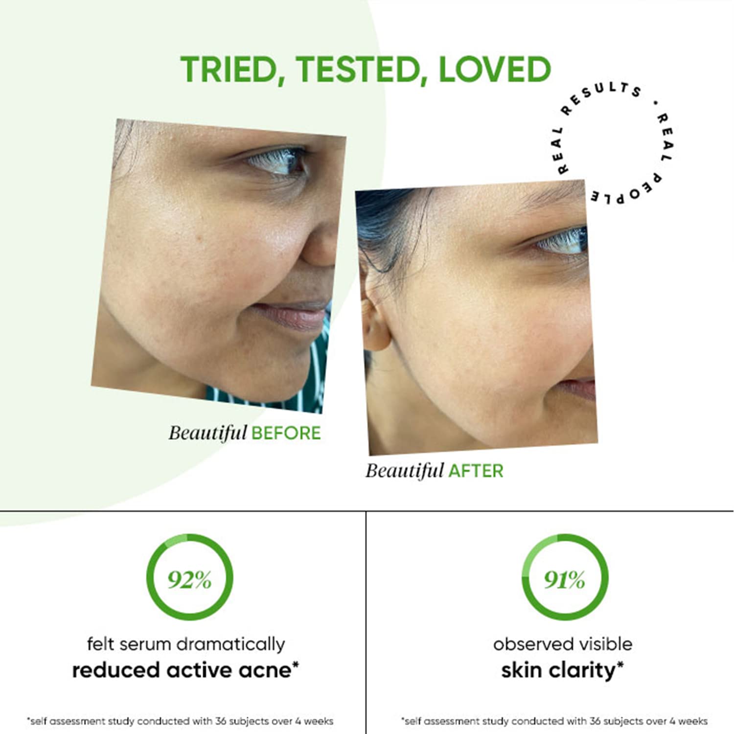 Dot & Key 2% Salicylic Acid + Cica Anti Acne Serum with Zinc – view 6