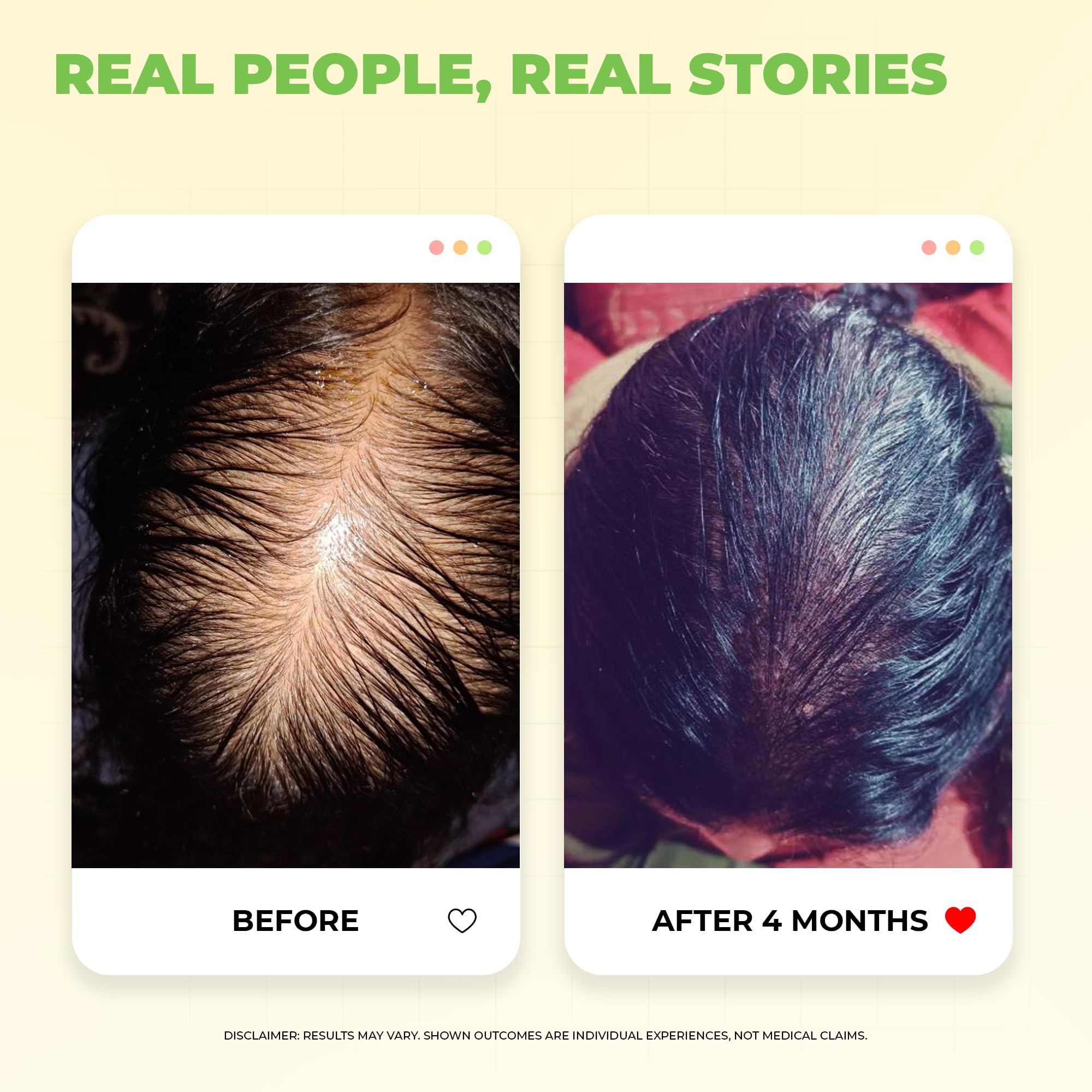 Avimee Herbal Scalptone Hair Growth Serum – view 5