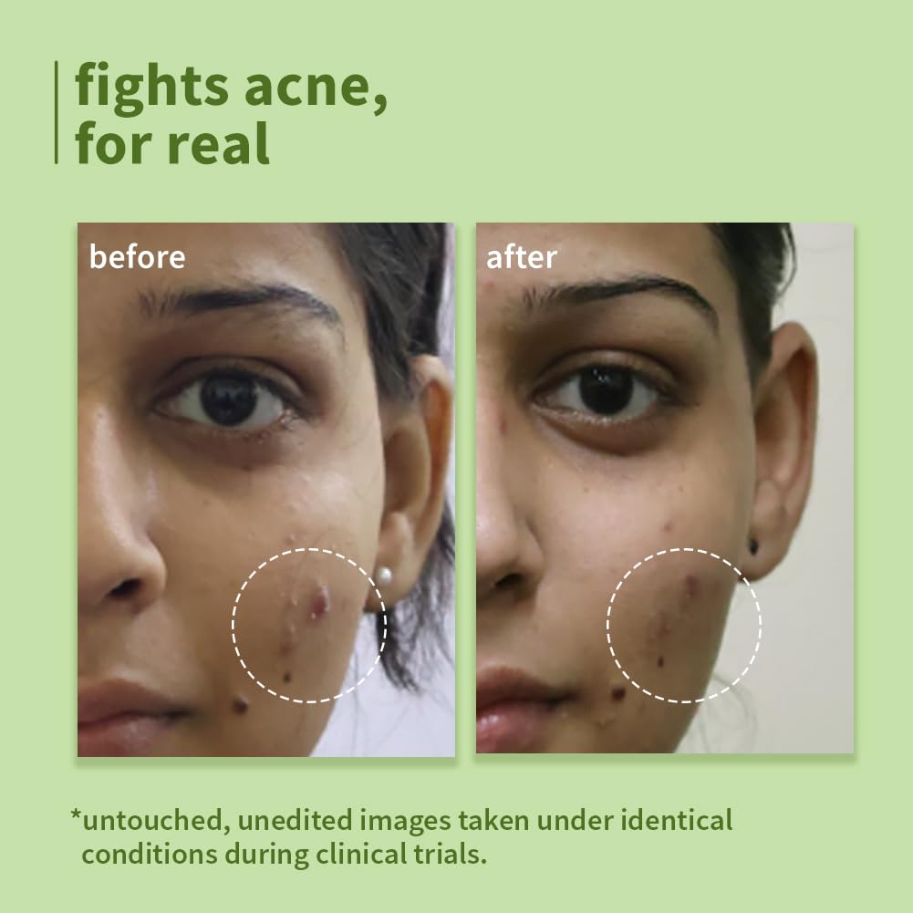 Plum Green Tea Pore Cleansing Face Wash for Oily, Acne Prone, Dry & Combination Skin – view 4