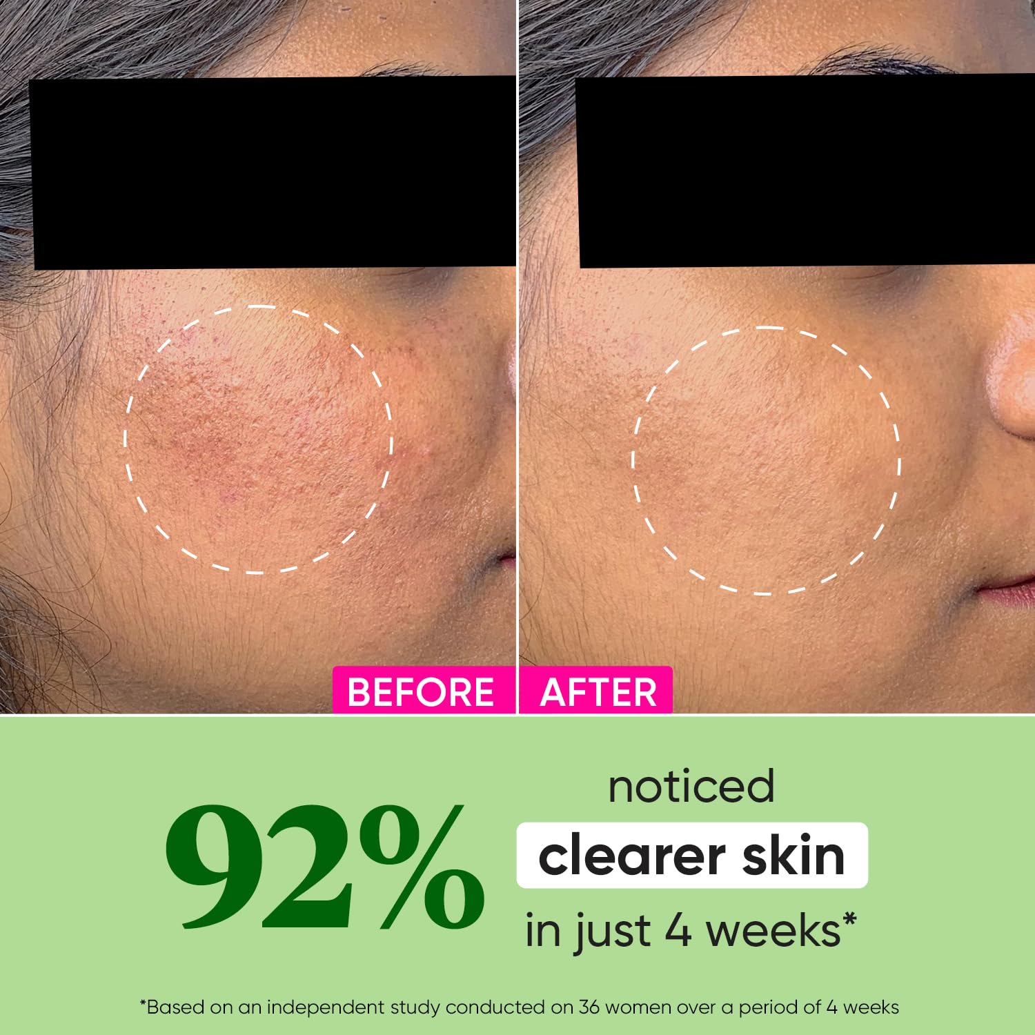 Dot & Key CICA + Niacinamide Oil Free Moisturizer for Acne Prone Skin – view 3