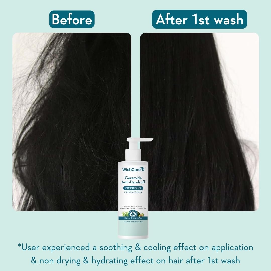 WishCare Ceramide Anti Dandruff Conditioner – view 2