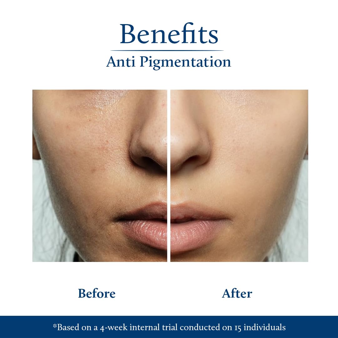 Blue Nectar Rice Water Kojic Acid Face Serum for Pigmentation & Dark Spots Removal – view 6