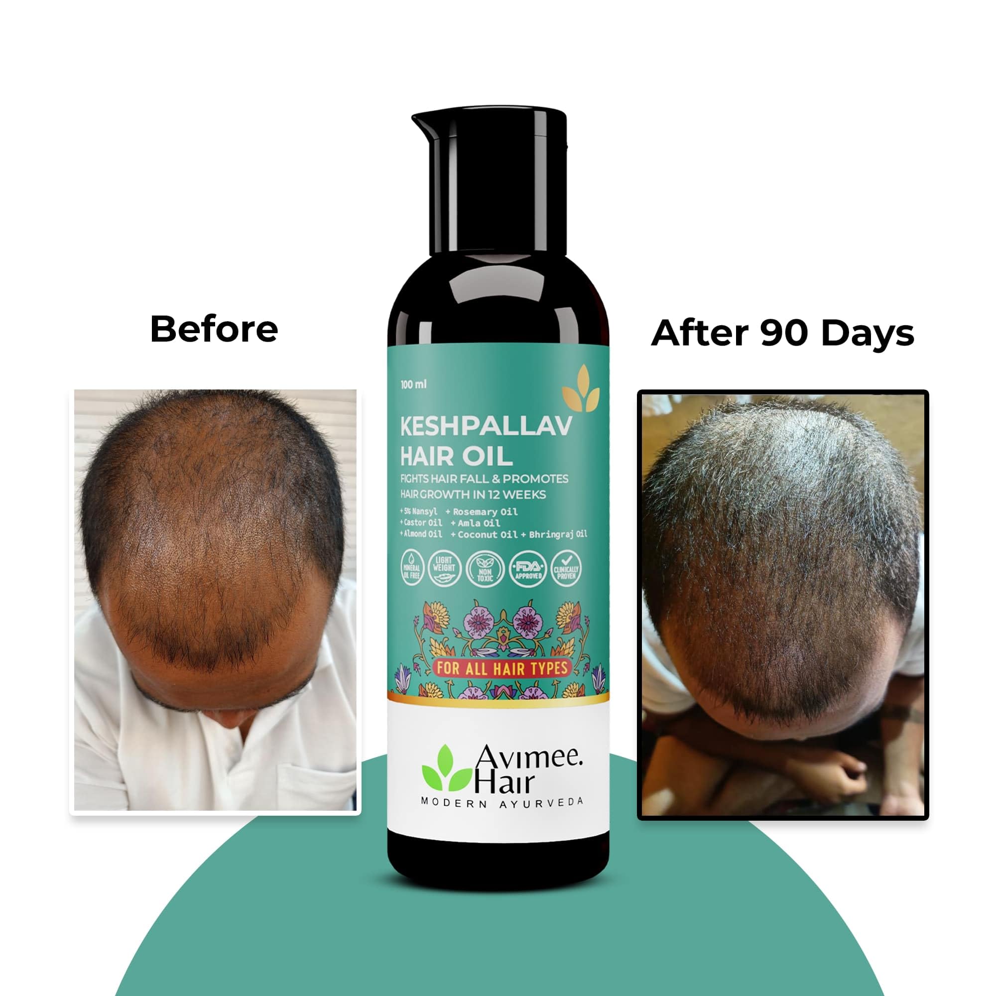 Avimee Herbal Keshpallav Hair Oil For Men & Women – view 3