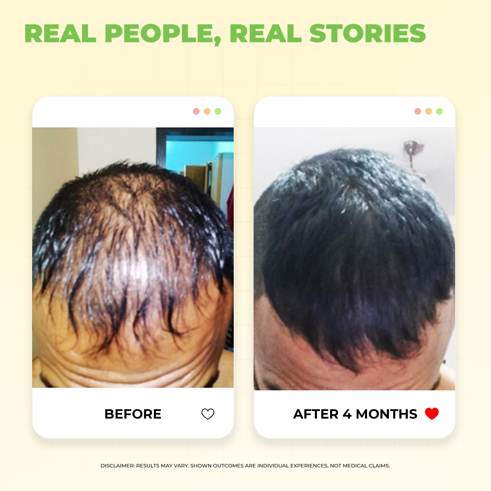 Avimee Herbal Hairtone PV 1 Scalp Tonic – view 5