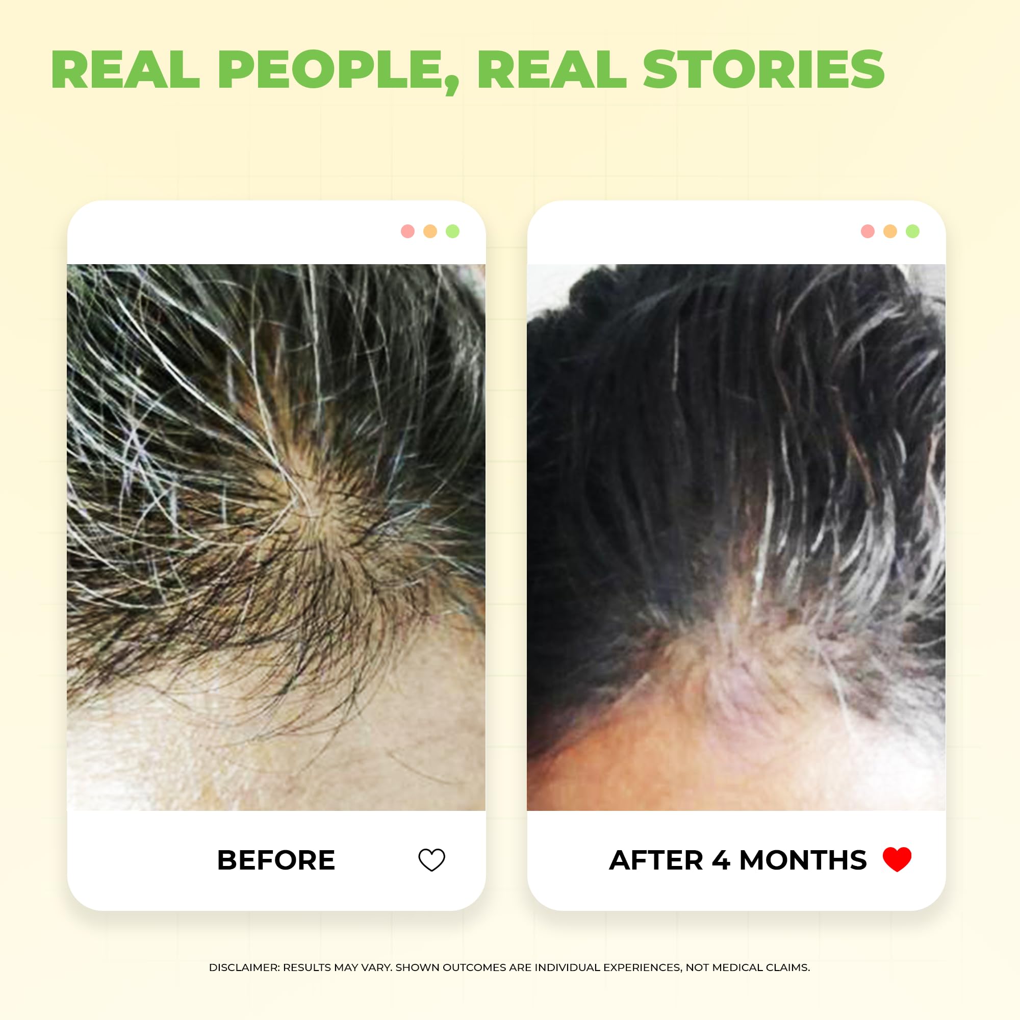 Avimee Herbal Scalptone Grey Hair Serum with Hyaluronic Acid & Caffeine – view 5