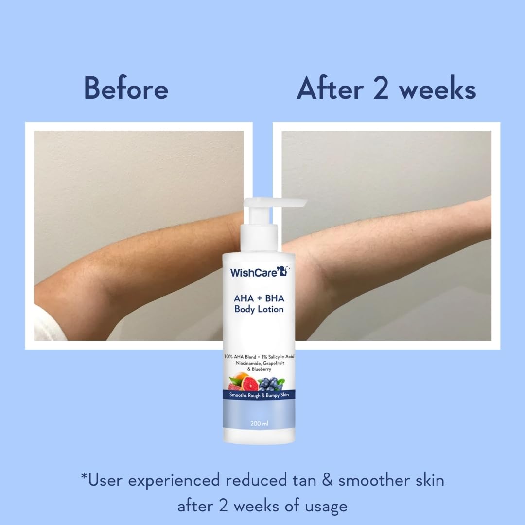 WishCare 10% AHA + 1% BHA Body Lotion for Men & Women - Body lotion for dry skin - Detans, Smooths Rough & Bumpy Skin 200ml – view 3
