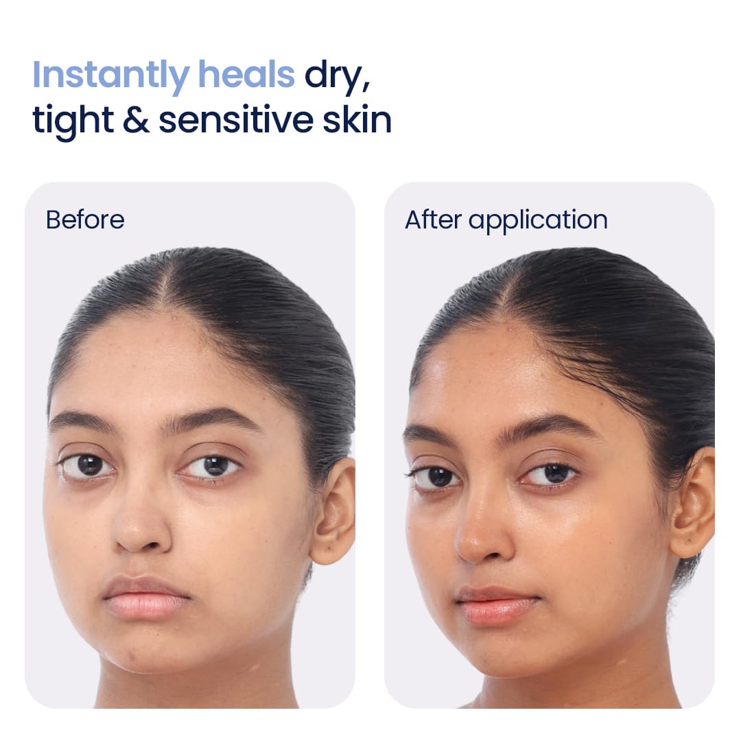 WishCare 3:1:1 Barrier Bounce Moisturizer for Face – view 3