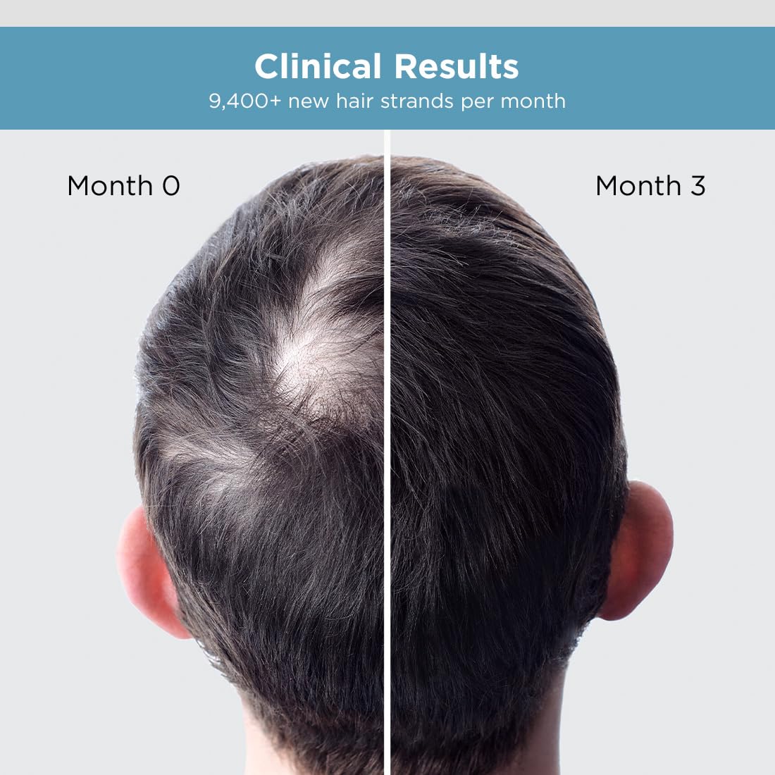 The Man Company Hair Growth Serum for Man (30ml) with 3% Redensyl, 4% Anagain, 3% Biacapil – view 5