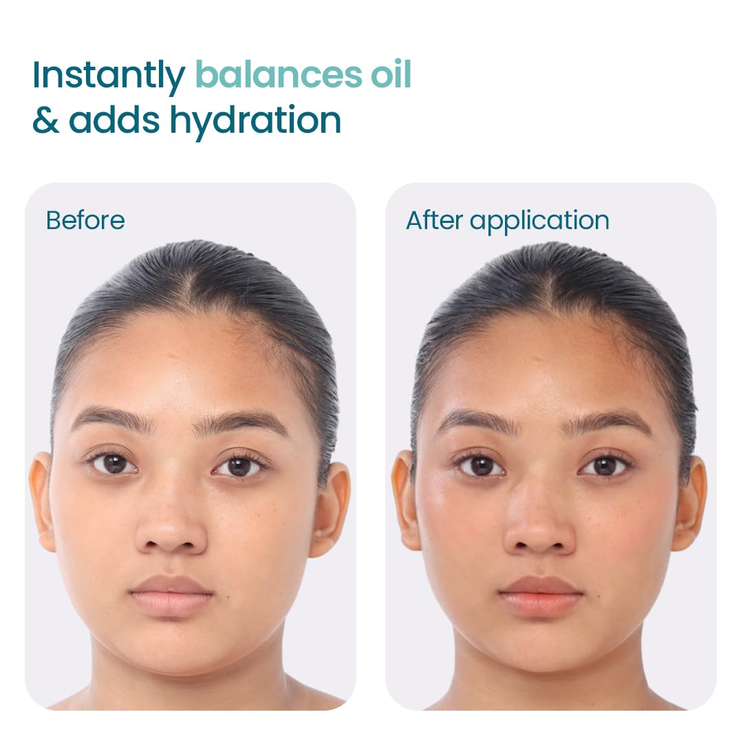 WishCare 2:1:3 NMF Water Gel Moisturizer for Oily & Sensitive Skin – view 3
