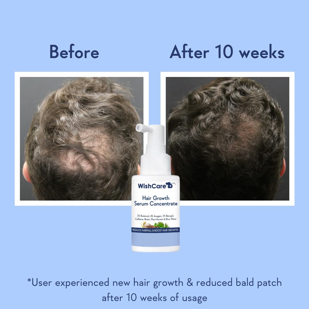 WishCare Hair Growth Serum Concentrate - 3% Redensyl, 4% Anagain, 2% Baicapil, Caffeine, Biotin & Rice Water - Advanced Hair Growth Serum for Hair Fall Control & Hair Growth 30ml – view 3