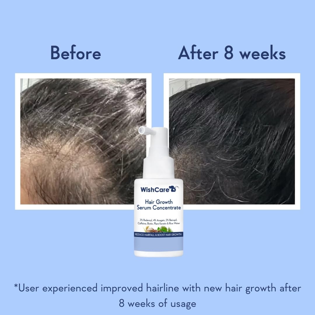 WishCare Hair Growth Serum Concentrate - 3% Redensyl, 4% Anagain, 2% Baicapil, Caffeine, Biotin & Rice Water - Advanced Hair Growth Serum for Hair Fall Control & Hair Growth 30ml – view 4