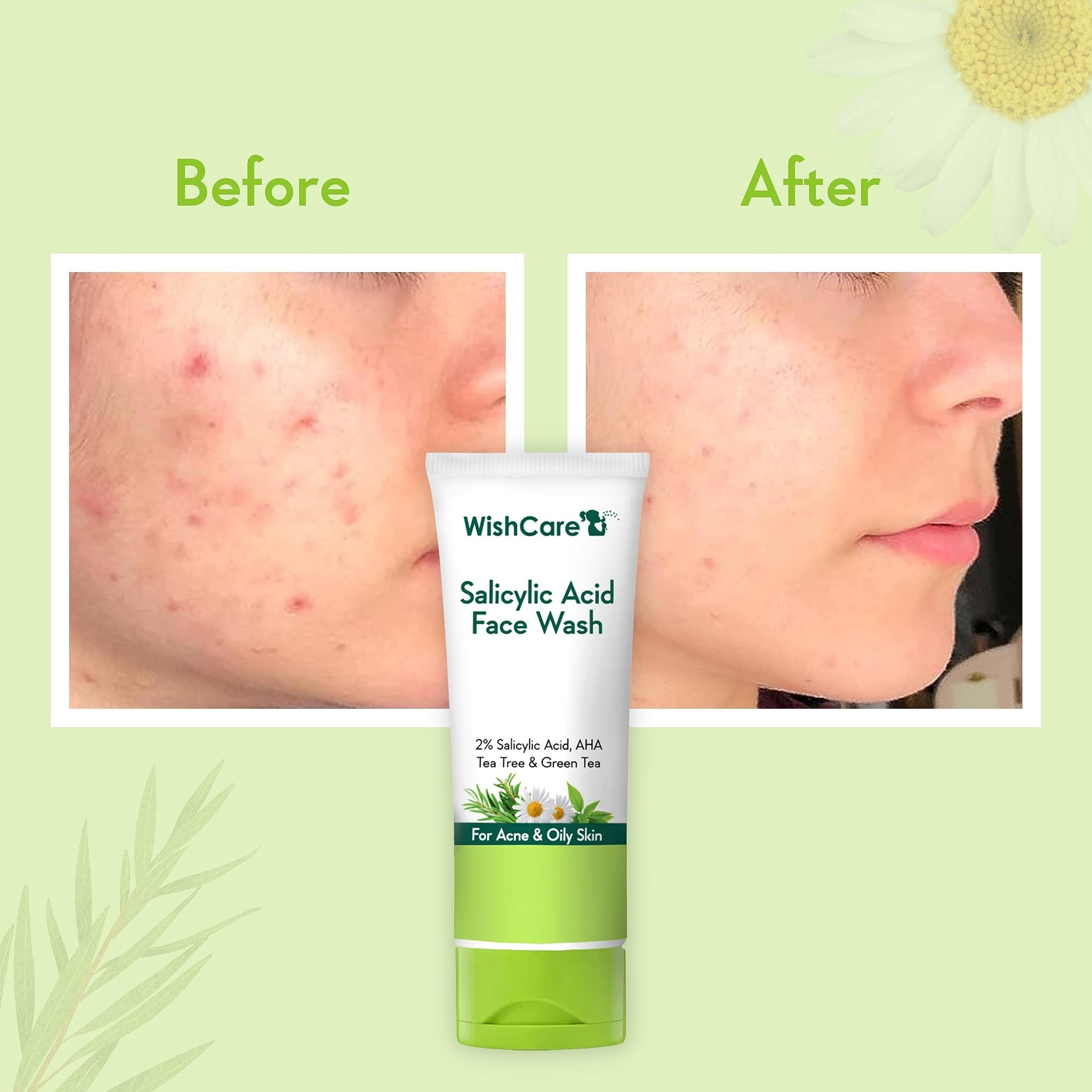 WishCare 2% Salicylic Acid Face Wash for Women & Men with AHA, GreenTea, Chamomile & TeaTree - Face Wash for Oily Skin & Acne Prone Skin 100ml – view 2