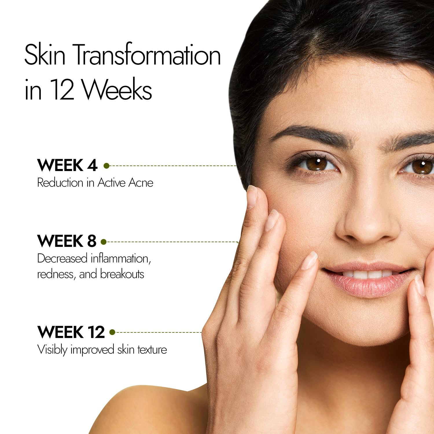 Kapiva Acne Ease Fizz – view 2