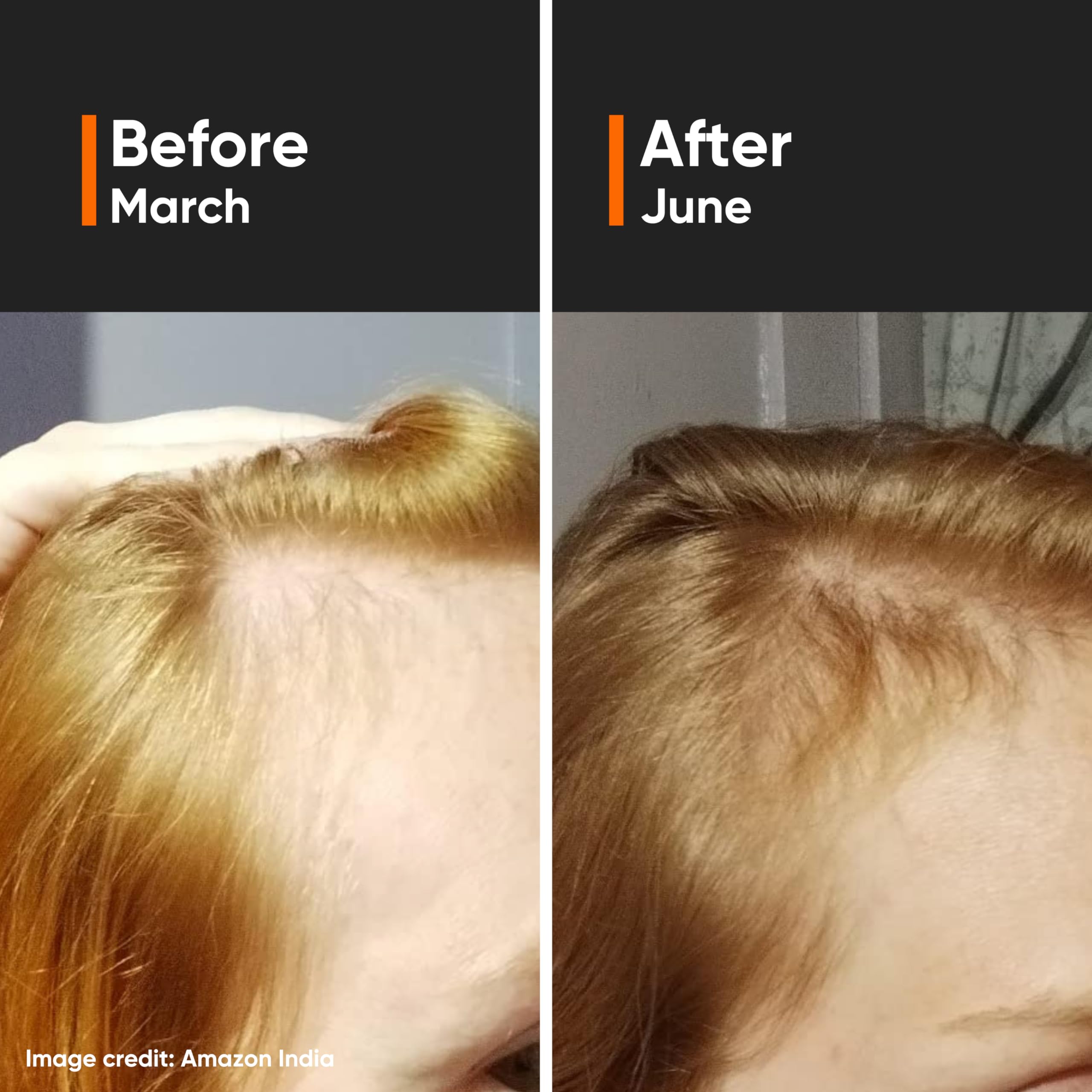 Minimalist Hair Growth Serum With 3% Redensyl, 3% Anagain, 3% Procapil, 5% Capixyl & 4% Baicapil 18% Hair Growth Actives – view 3