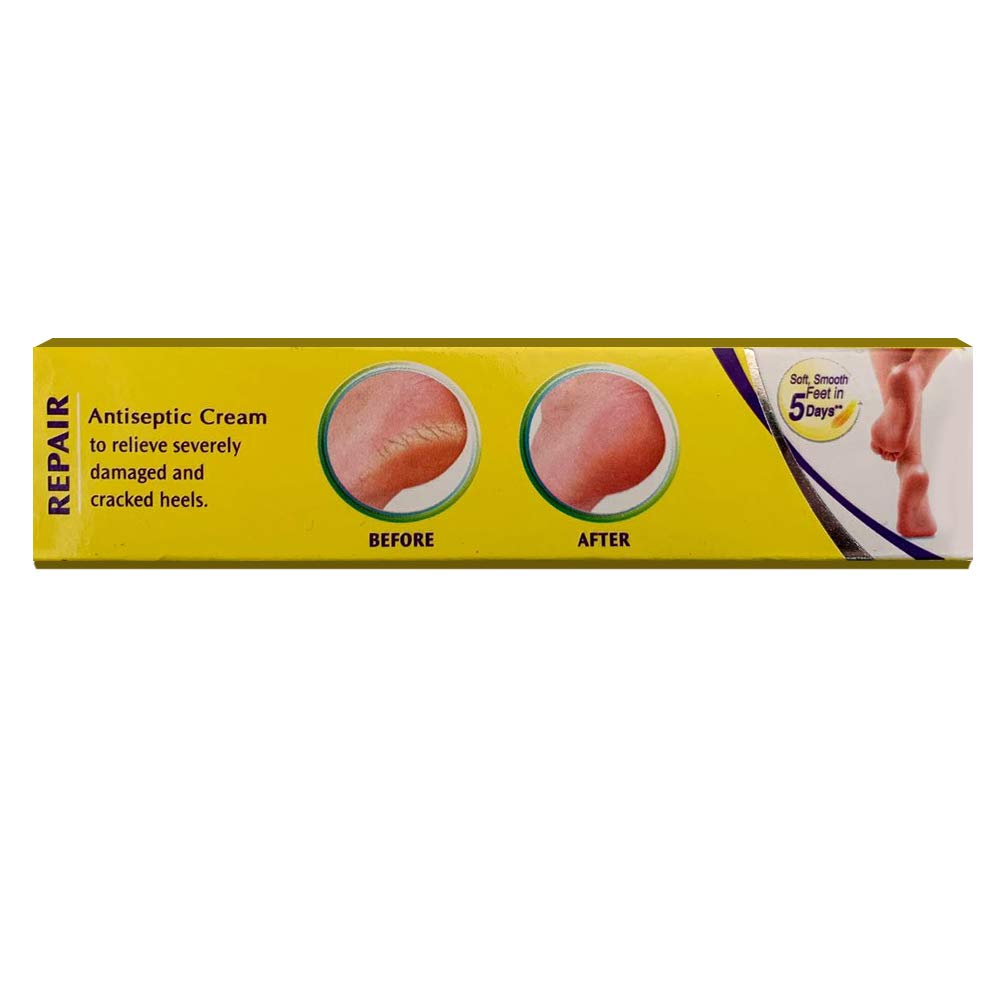 Krack Heel Repair, Ayurvedic Foot care cream, 25 Gm, Pack of 2 – view 9