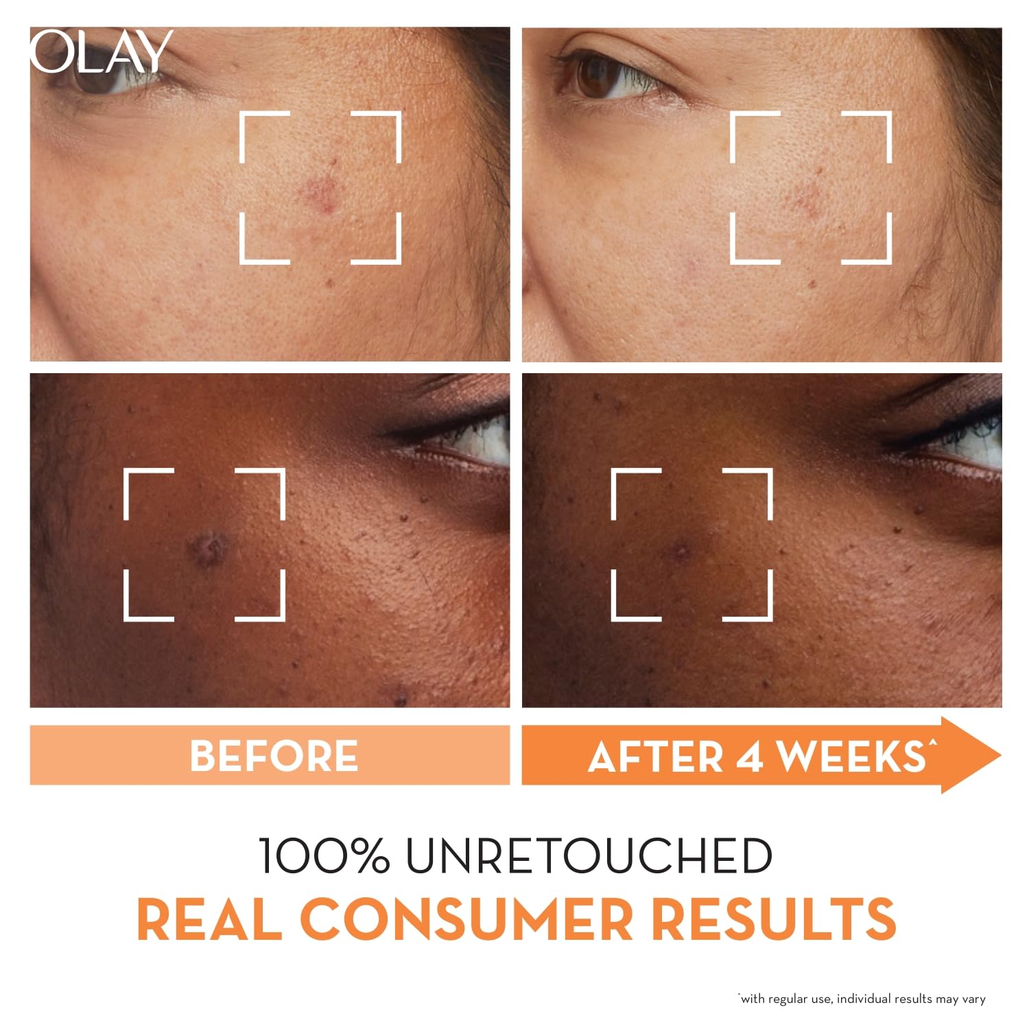 Olay Vitamin C Face Serum with Niacinamide l Even Glow & Smooth Texture l Normal, Oily, Dry & Combination Skin l Parabens & Sulphate-free l 30ml – view 3