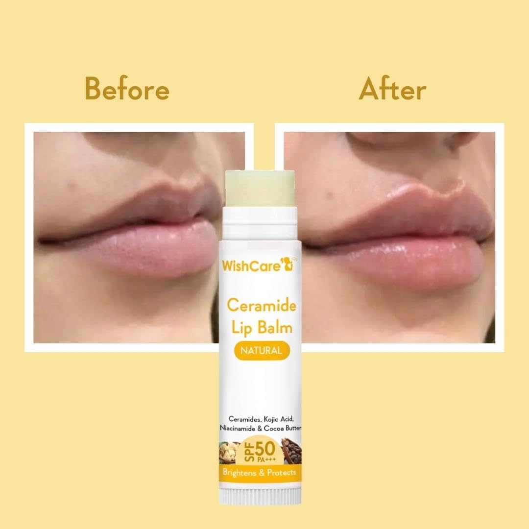 WishCare Ceramide Lip Balm with SPF 50 PA+++ – view 3
