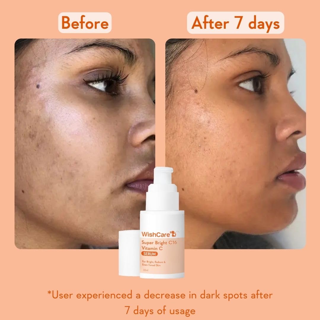 WishCare Super Bright C16 Vitamin C Serum For Oily Skin,Dry & Combination Skin -10% Vitamin C,4% Niacinamide,1% Kojic Acid,0.5% Ferulic Acid,Licorice & 4-N-BR- Serum For Pigmentation & Dark Spots 30Ml – view 3