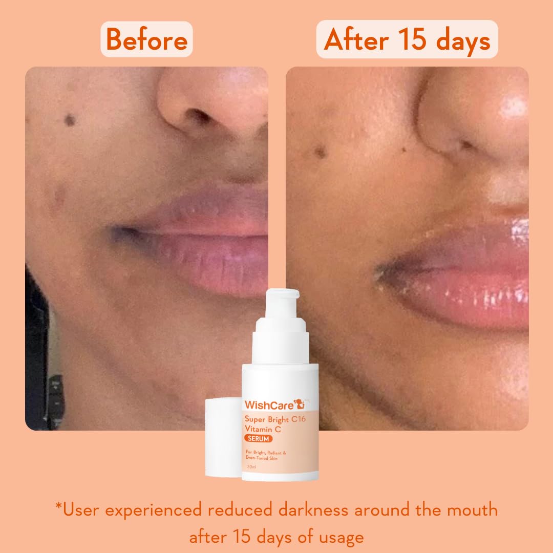 WishCare Super Bright C16 Vitamin C Serum For Oily Skin,Dry & Combination Skin -10% Vitamin C,4% Niacinamide,1% Kojic Acid,0.5% Ferulic Acid,Licorice & 4-N-BR- Serum For Pigmentation & Dark Spots 30Ml – view 4