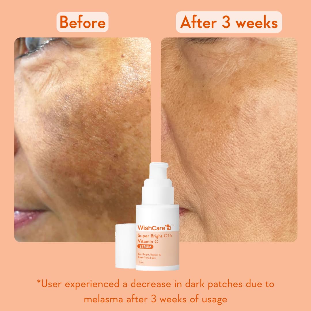 WishCare Super Bright C16 Vitamin C Serum For Oily Skin,Dry & Combination Skin -10% Vitamin C,4% Niacinamide,1% Kojic Acid,0.5% Ferulic Acid,Licorice & 4-N-BR- Serum For Pigmentation & Dark Spots 30Ml – view 5