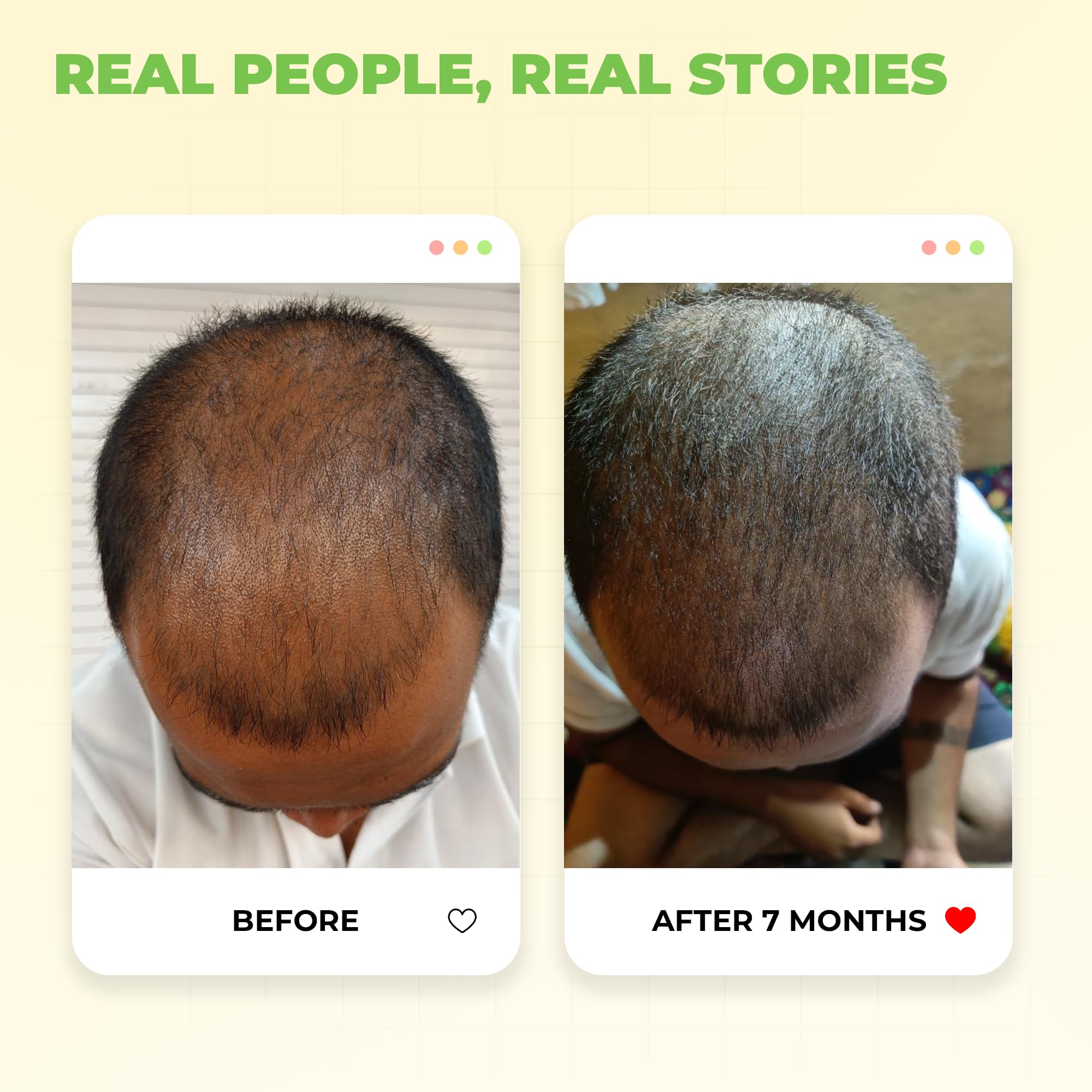 Avimee Herbal Keshpallav Hair Oil for Hair Growth – view 5
