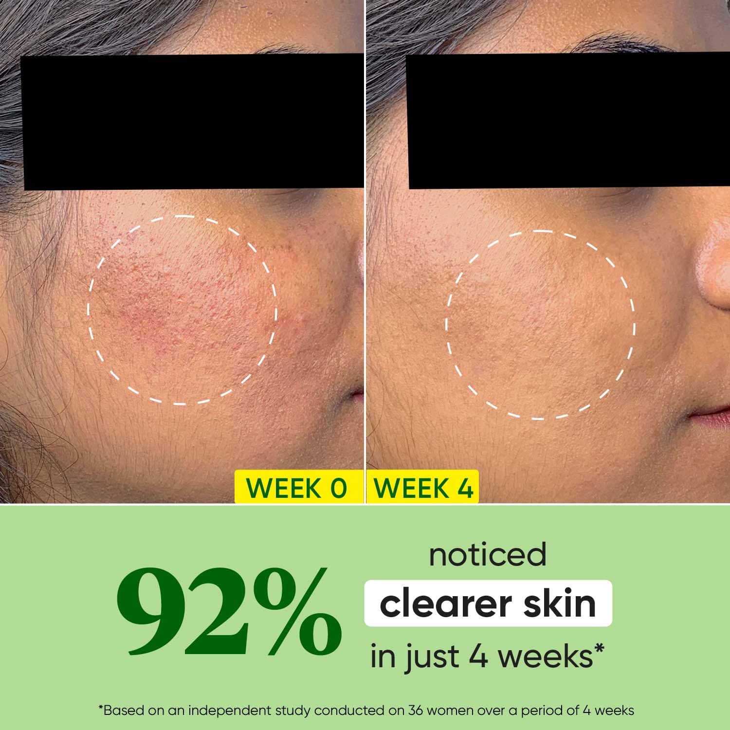 DOT & KEY Cica + Niacinamide Oil-Free Face Moisturizer For Calm, Acne Free Hydrated Skin Fades Acne Scars & Dark Spots, Soothes Redness & Irritation – view 3
