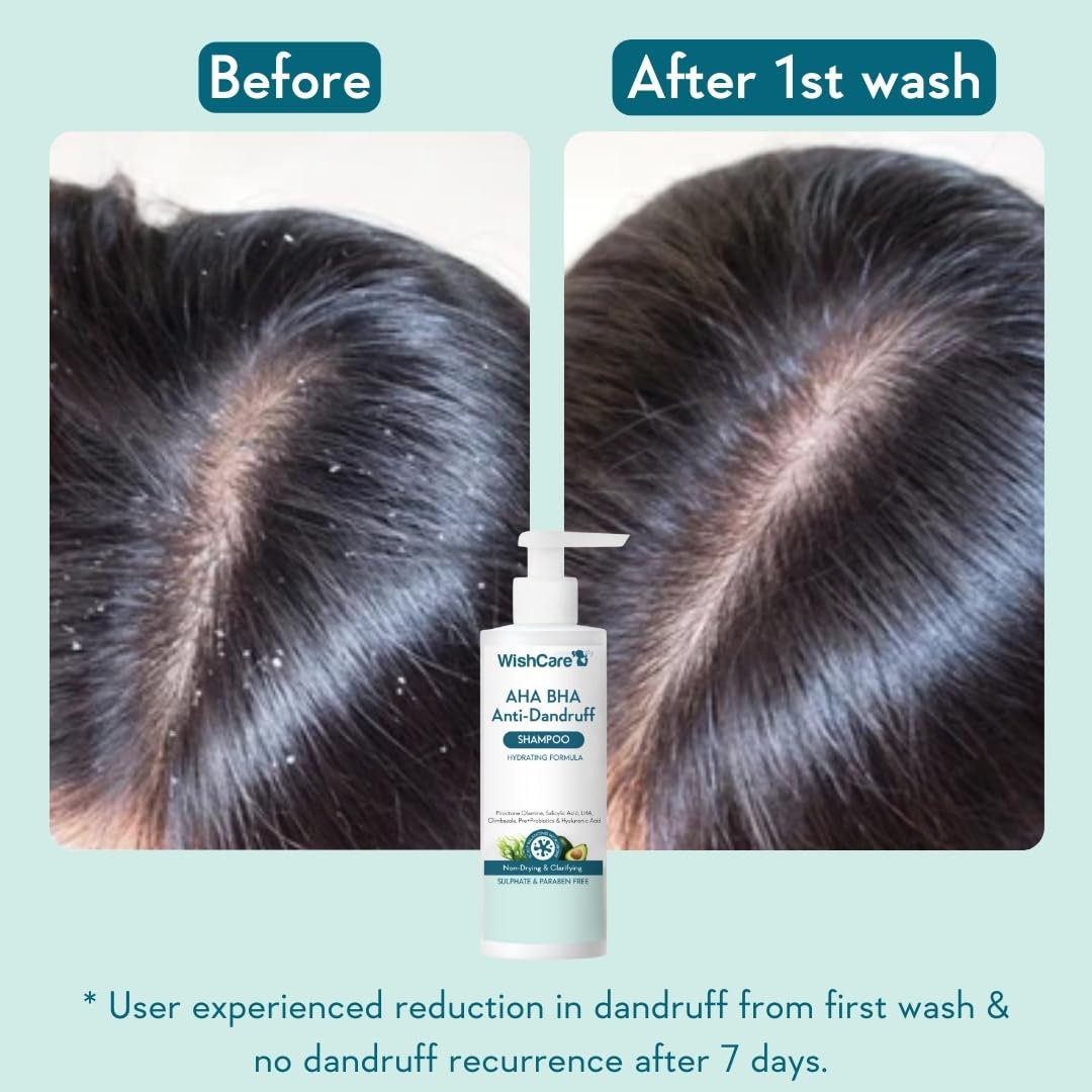 WishCare Hydrating Anti Dandruff Shampoo – view 2