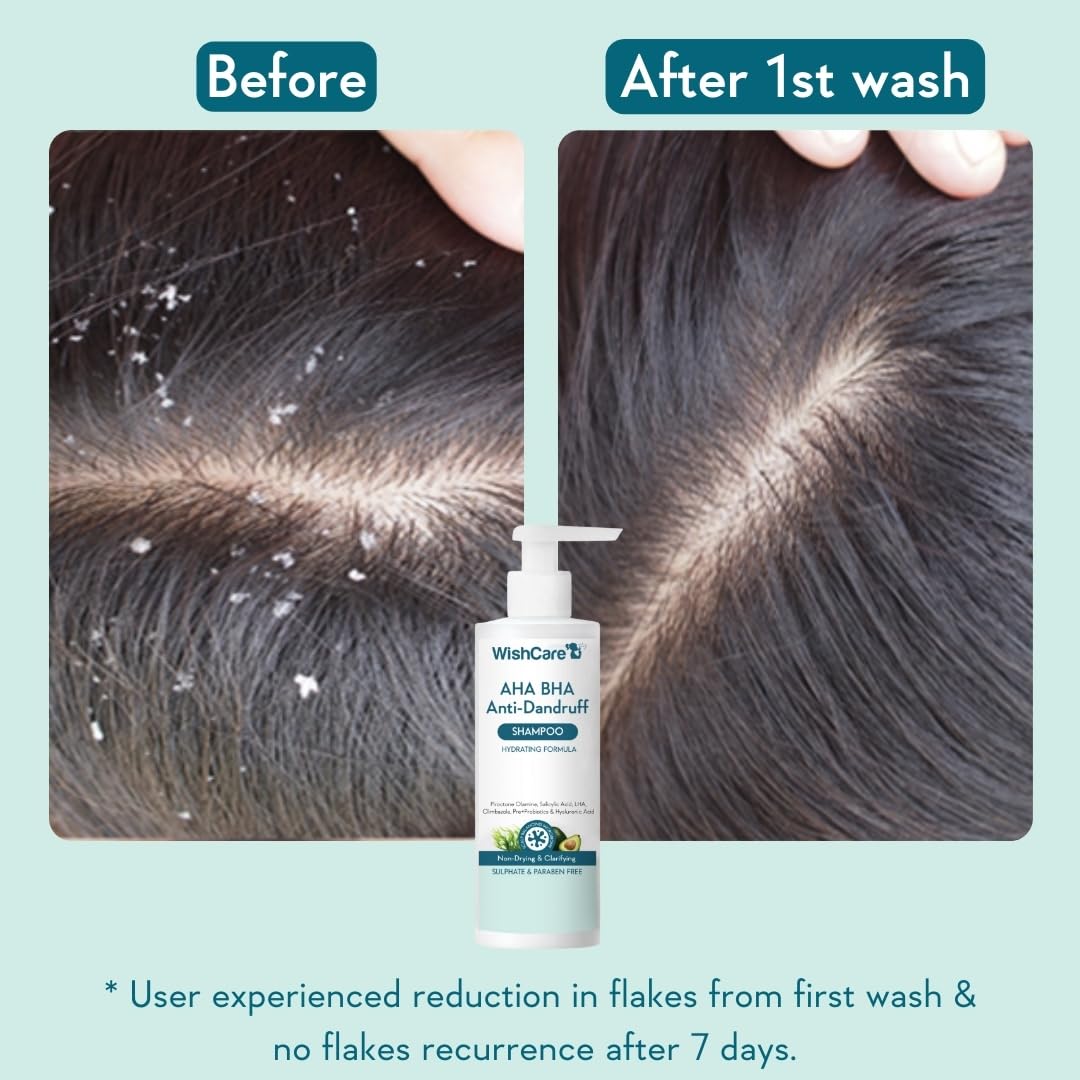 WishCare Hydrating Anti Dandruff Shampoo – view 3