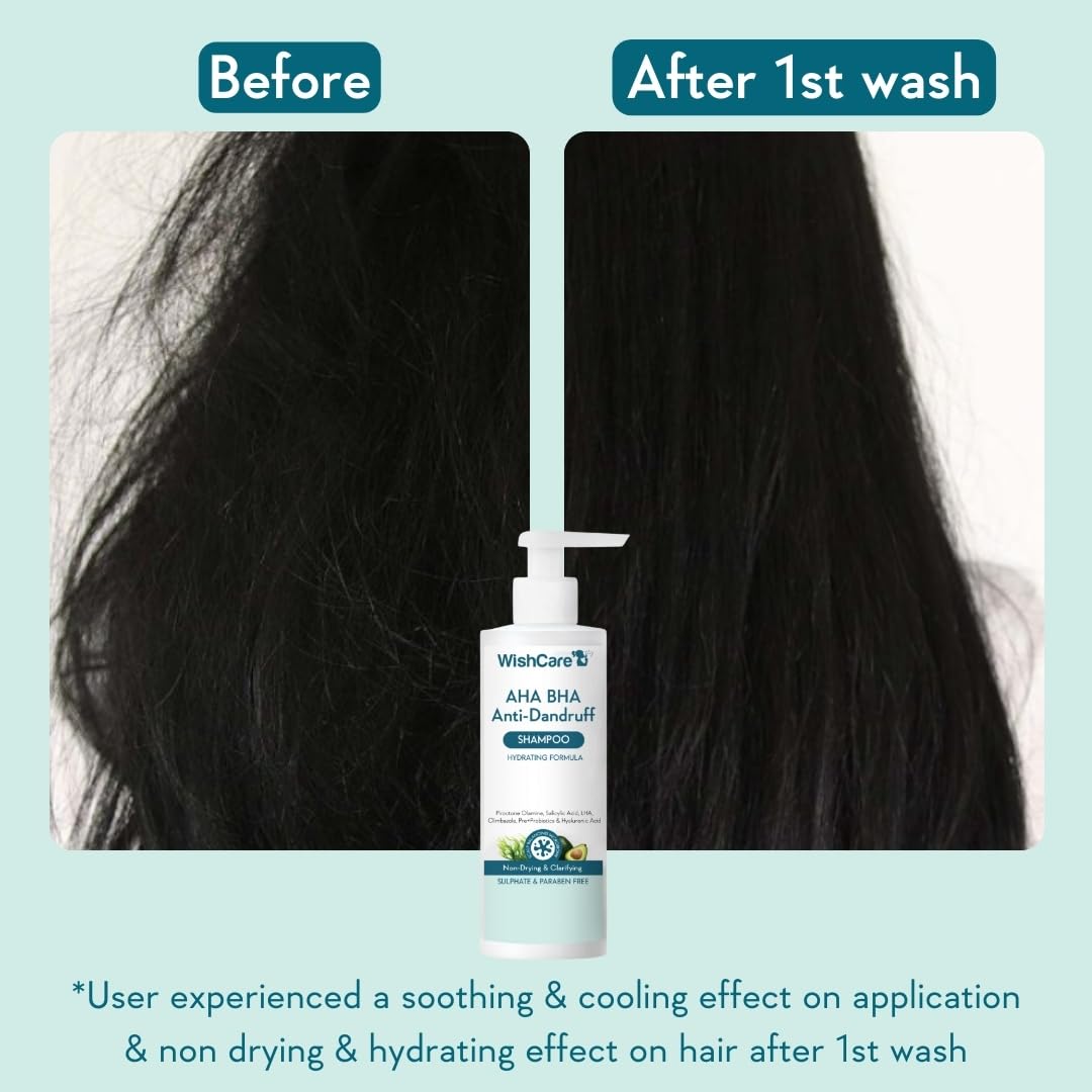 WishCare Hydrating Anti Dandruff Shampoo – view 4