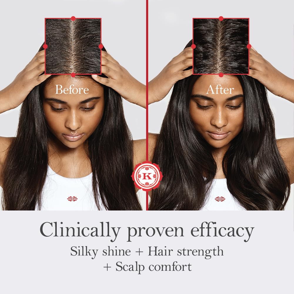 Kama Ayurveda Bringadi Intensive Hair Treatment Oil, 200ml(Hair Oil) – view 3