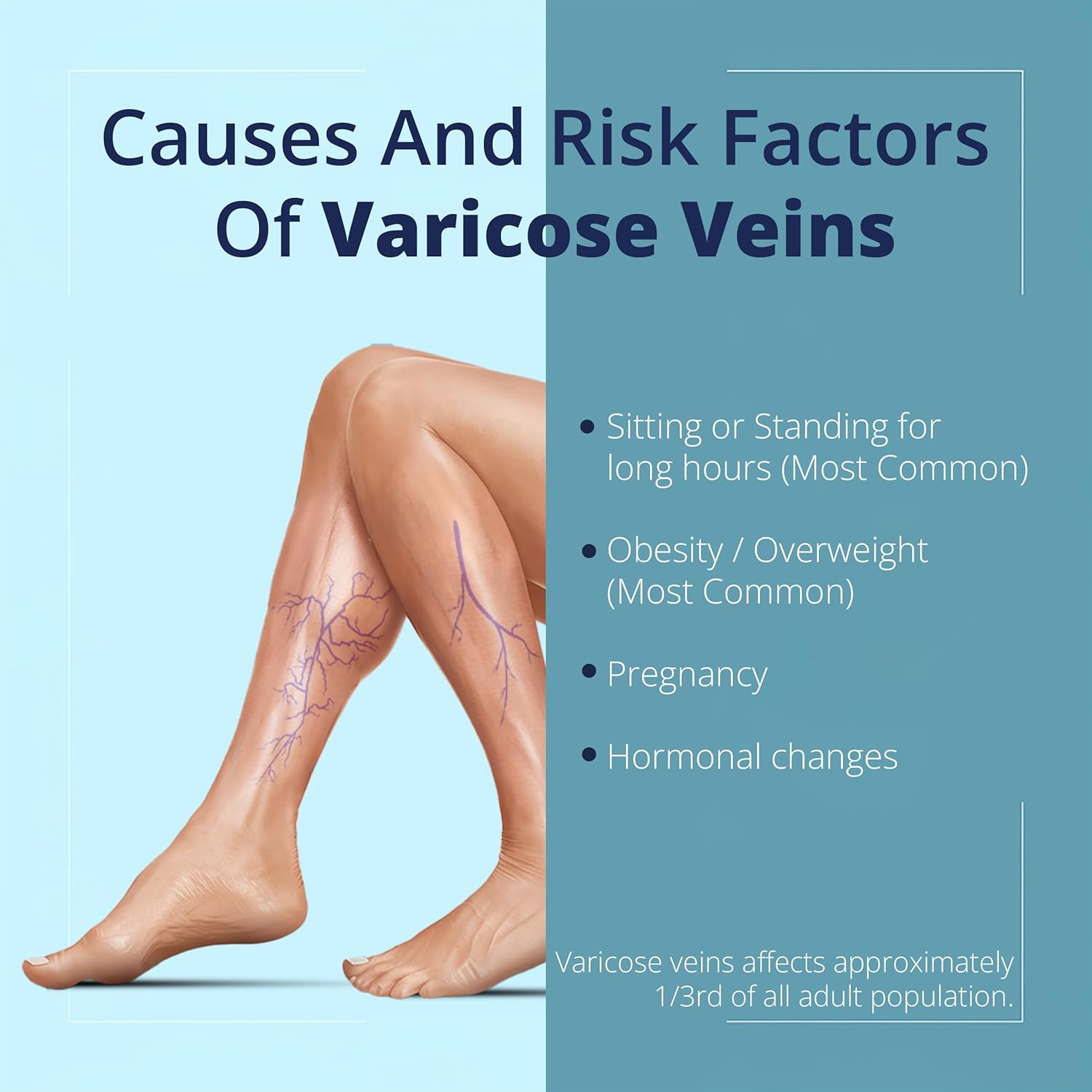 PENIKOSETE Cream Ayurvedic Solution For Management Of Varicose Veins, Spider Veins, Varicocele Reduces Cramps, Itching & Swelling. Buy 2 Get 1 Free (75 gms). – view 3