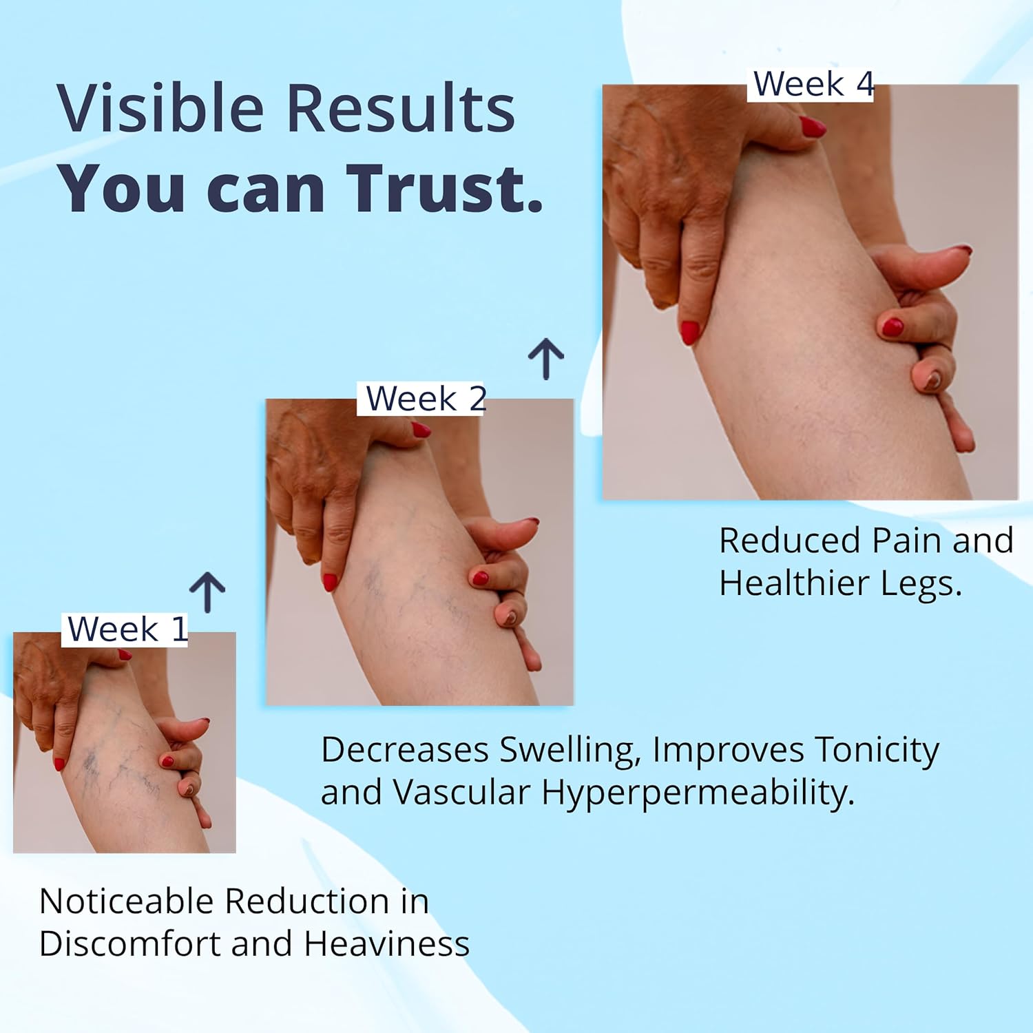 PENIKOSETE Cream Ayurvedic Solution For Management Of Varicose Veins, Spider Veins, Varicocele Reduces Cramps, Itching & Swelling. Buy 2 Get 1 Free (75 gms). – view 8