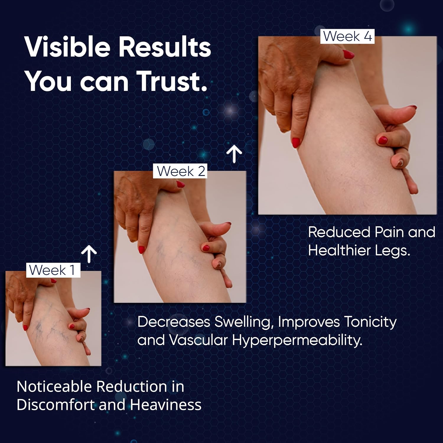 PENIKOSETE Advanced Vein Treatment Kit with Ashwagandha Cream & Tablets – view 7