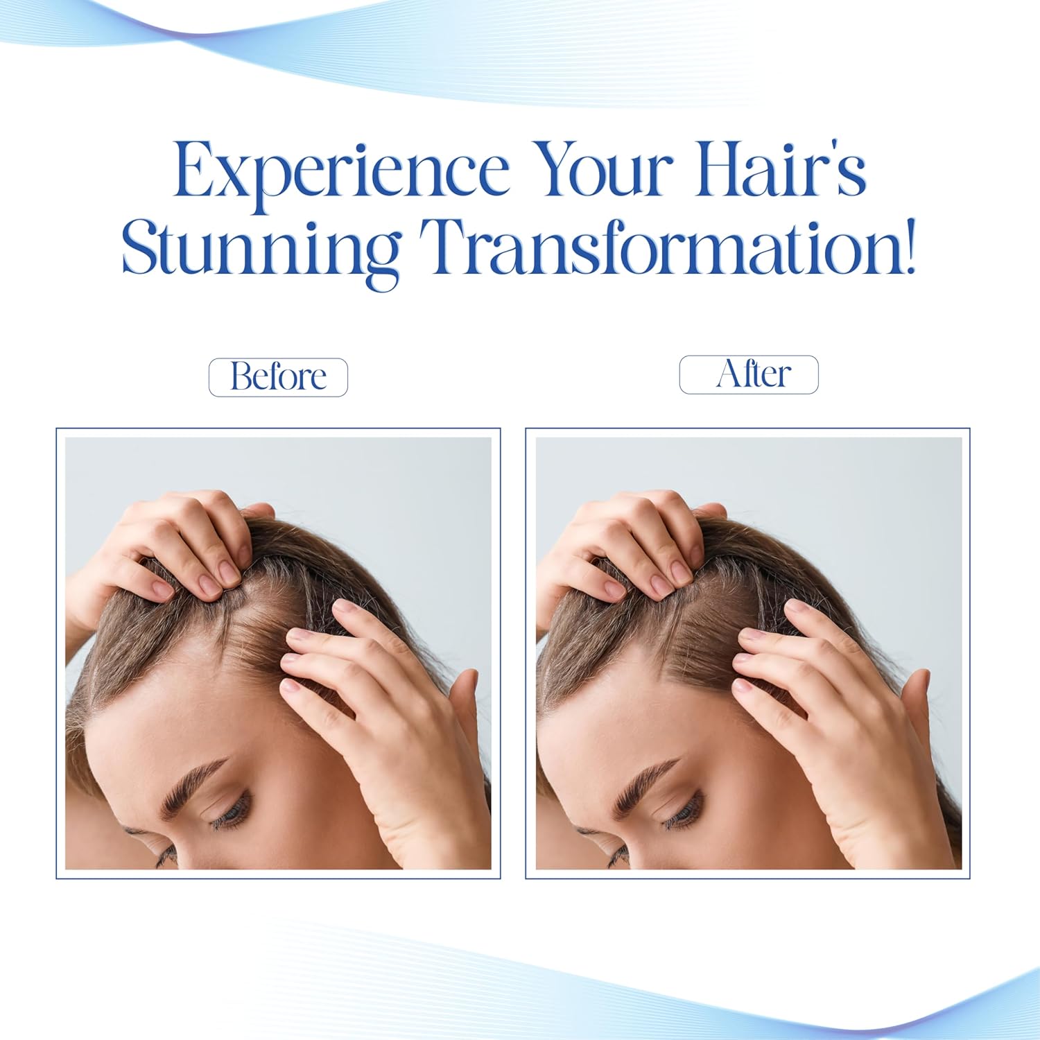 VCare Hair Growth Vitalizer for Men & Women, Oil-Free Hair Serum, Reduces Hair Fall, Boosts Hair Growth, Nourishes Scalp, Non-Sticky Formula, 2 x 100ml, Hair Care Essential for All Hair Types – view 4