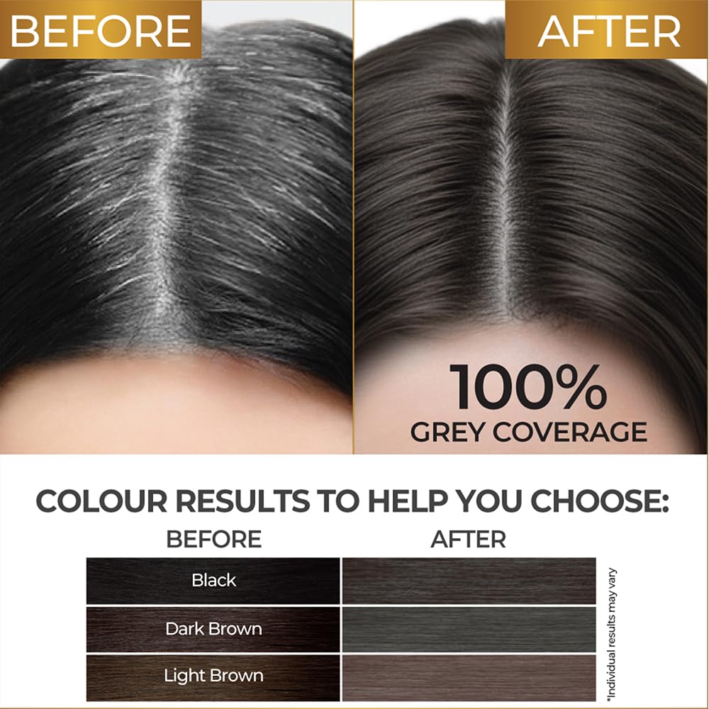 Streax Gel Hair Colour for Women & Men, Natural Brown 4, 150ml – view 9